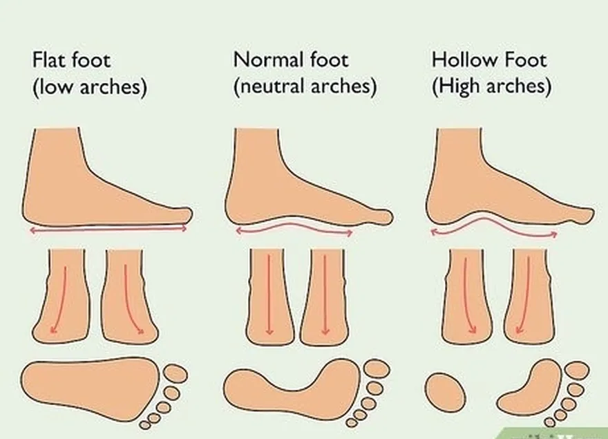 étape 3 connaître le type de pied que l'on a.