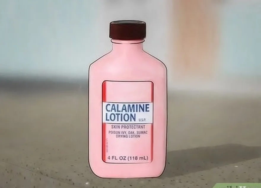 étape 3 tamponnez la piqûre avec de la lotion à la calamine.