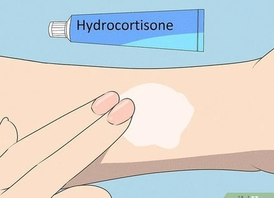 vous pouvez également utiliser une crème à l'hydrocortisone (anti-démangeaisons).