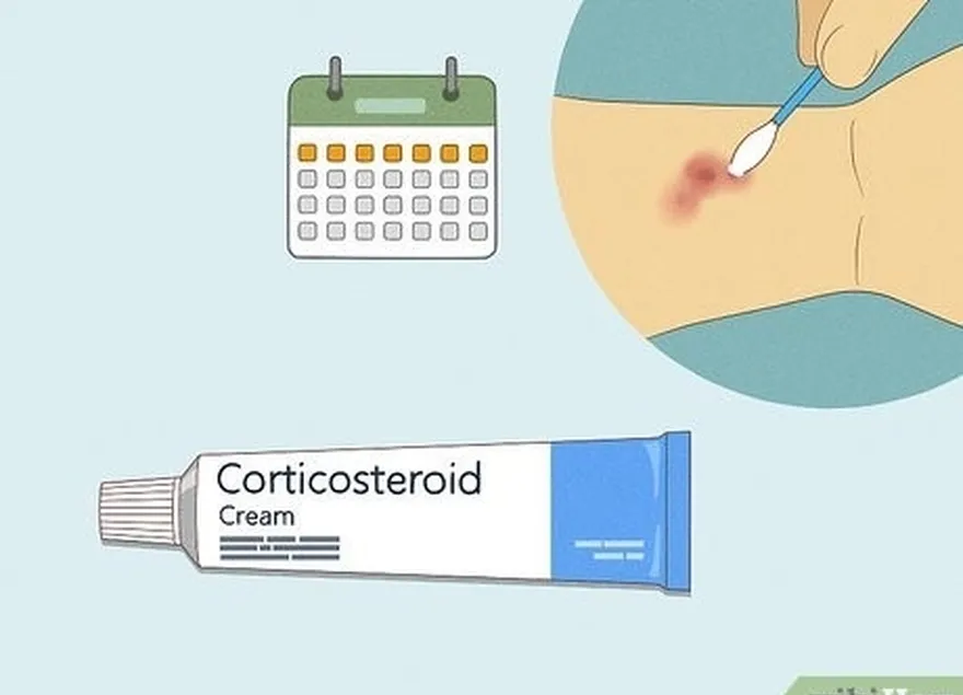 étape 1 utilisez une crème corticostéroïde en vente libre pendant une semaine.