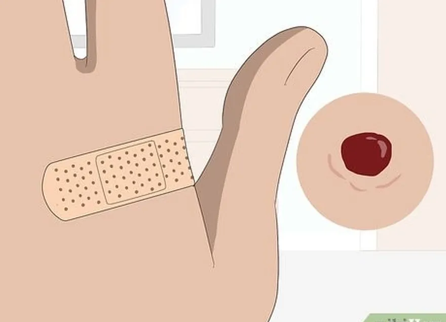 étape 3 : couvrez la peau abîmée avec de la gaze ou un bandage.