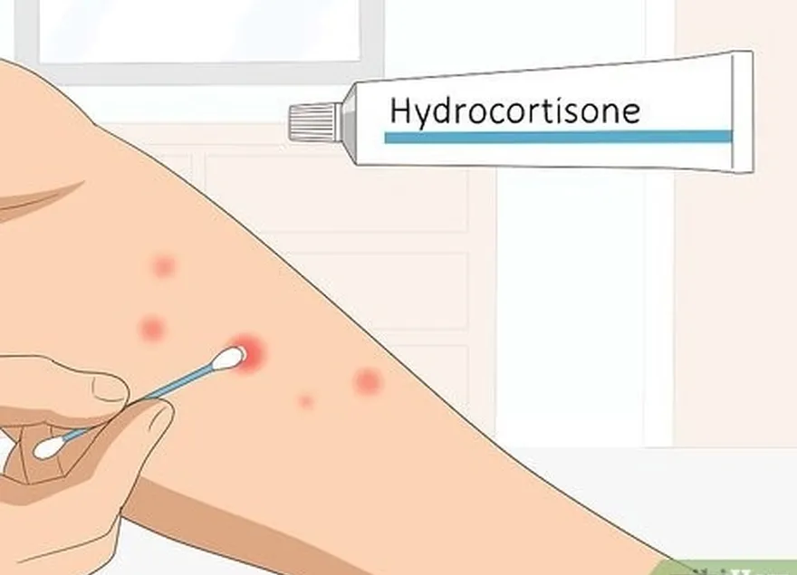 étape 2 essayez une crème à base d'hydrocortisone ou d'antihistaminique en vente libre.