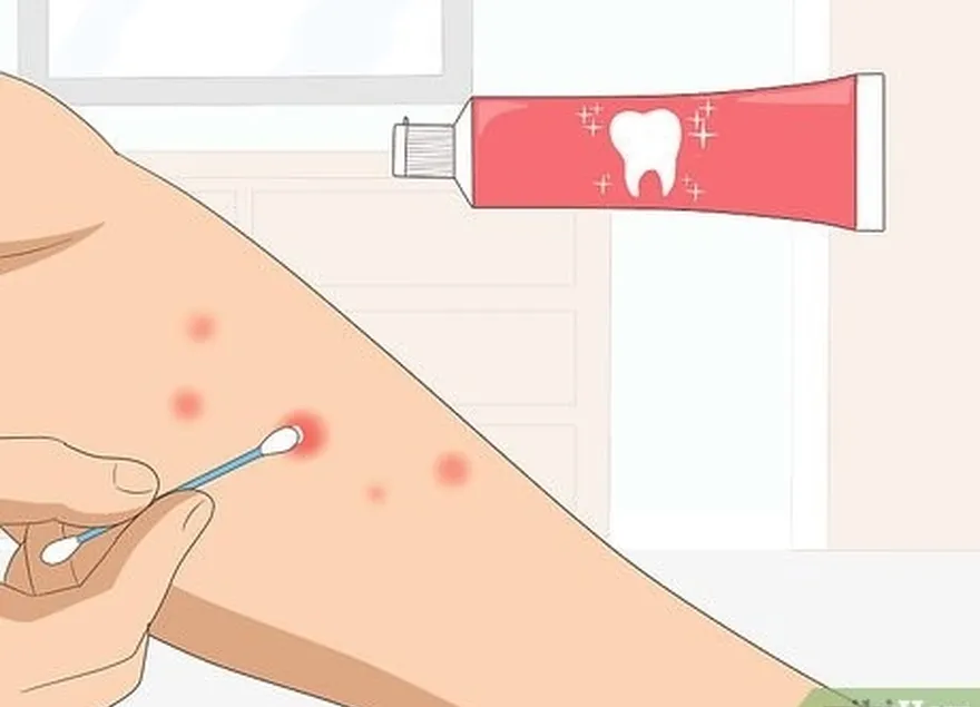 étape 3 tamponnez la piqûre avec du dentifrice.