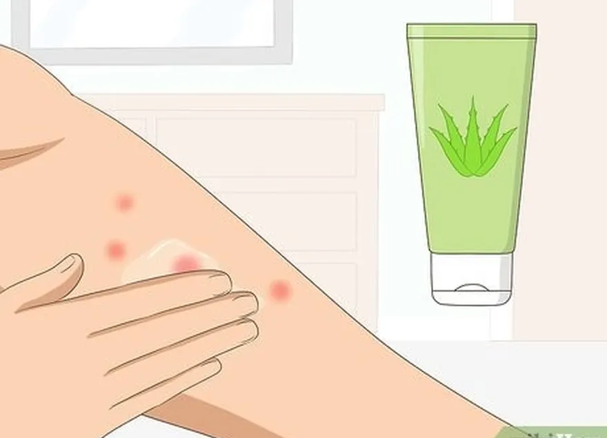 étape 4 : enduisez votre peau de lotion ou de gel à l'aloe vera.