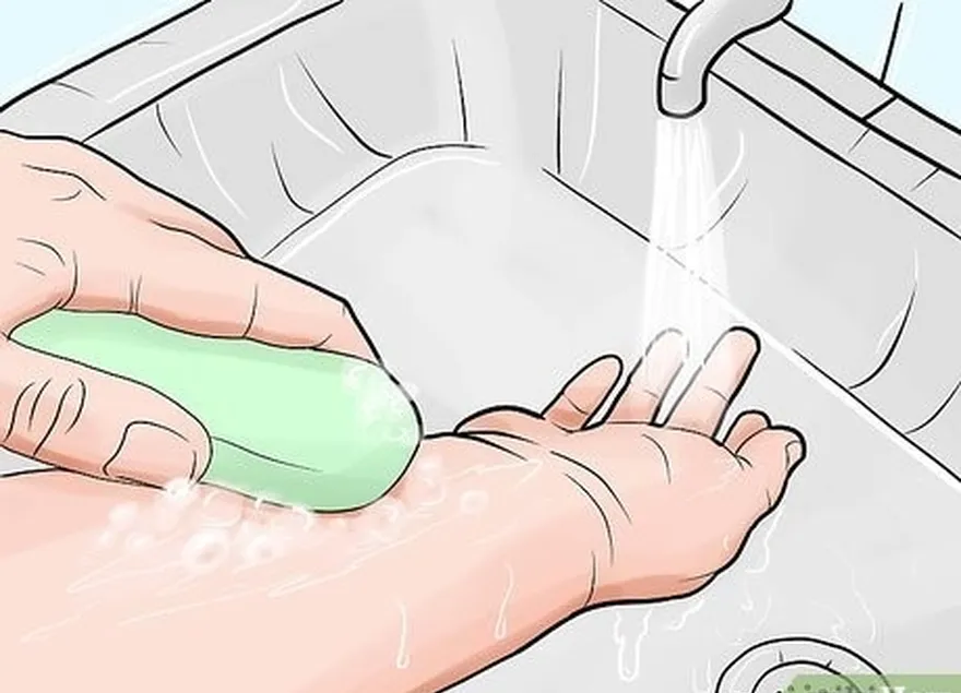 étape 1 laver la zone affectée avec de l'eau et du savon après la piqûre.