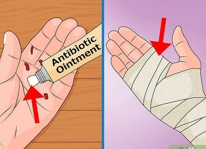 étape 10 appliquer une pommade antibiotique sur les plaies.