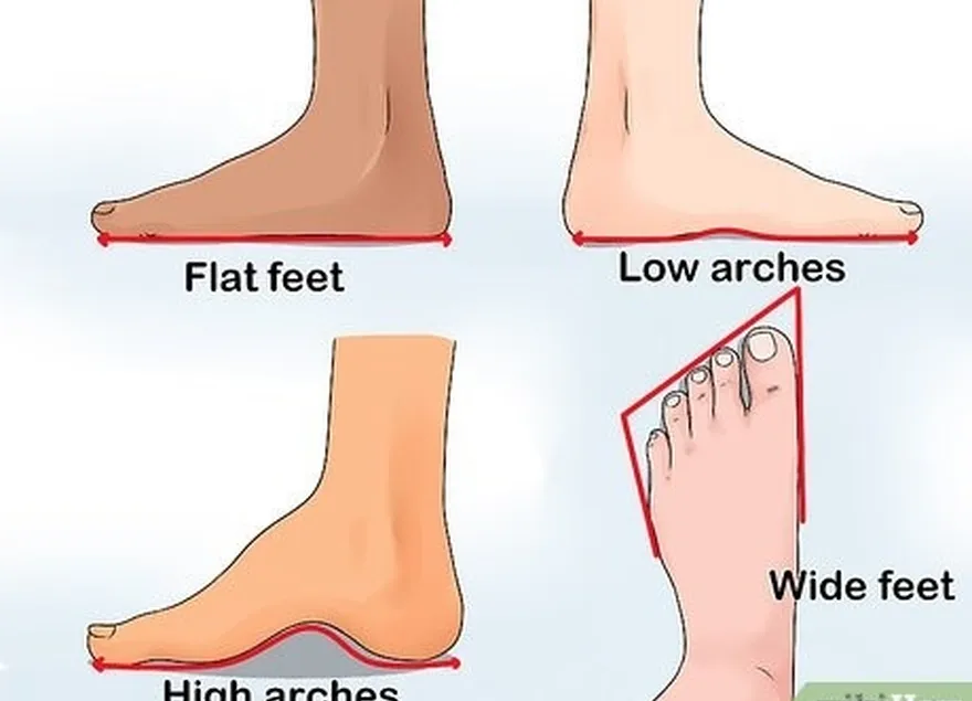 étape 1 déterminez si vous avez des problèmes ou des variations au niveau des pieds.