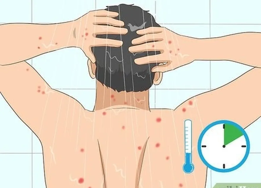 étape 3 prenez une douche froide en cas de piqûres multiples de moucherons.