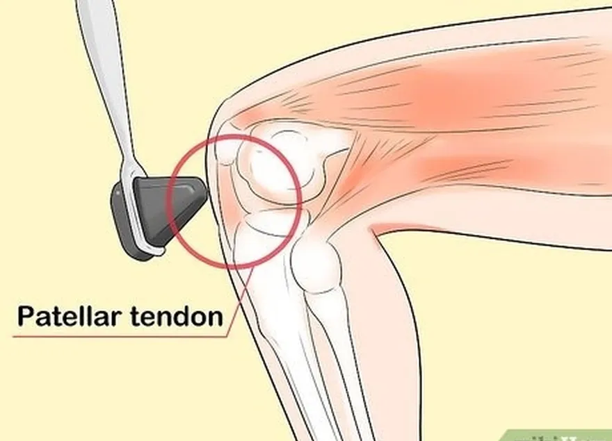 étape 3 localisez le tendon que vous allez tapoter.