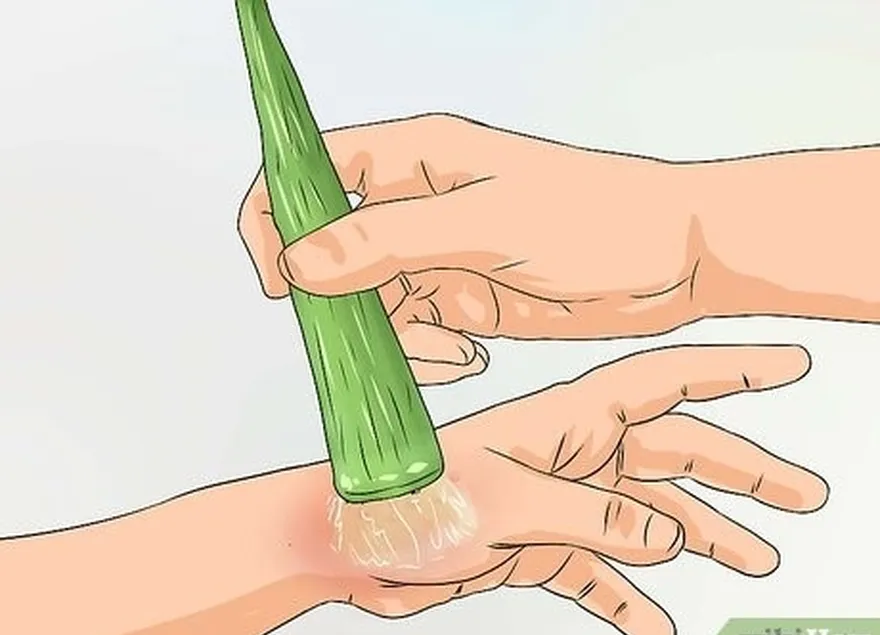 étape 6 utiliser de l'aloe vera.