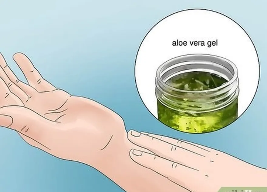 étape 2 appliquer du gel d'aloe vera pour rafraîchir et apaiser la peau.