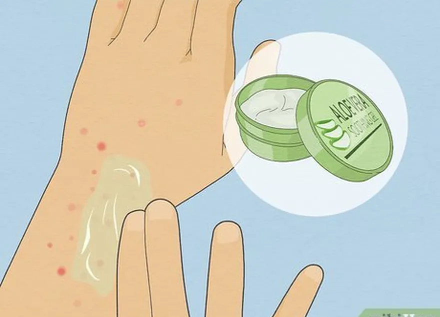 étape 6 tamponnez votre peau avec du gel d'aloe vera pour l'apaiser.