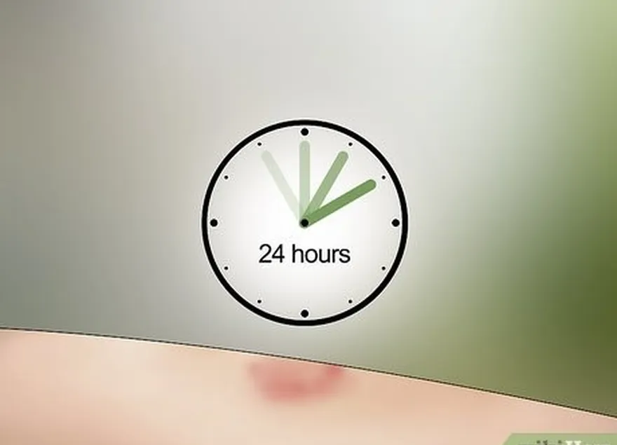 étape 7 surveillez la piqûre pendant les 24 heures suivantes pour vous assurer que les symptômes ne s'aggravent pas.'t worsen.
